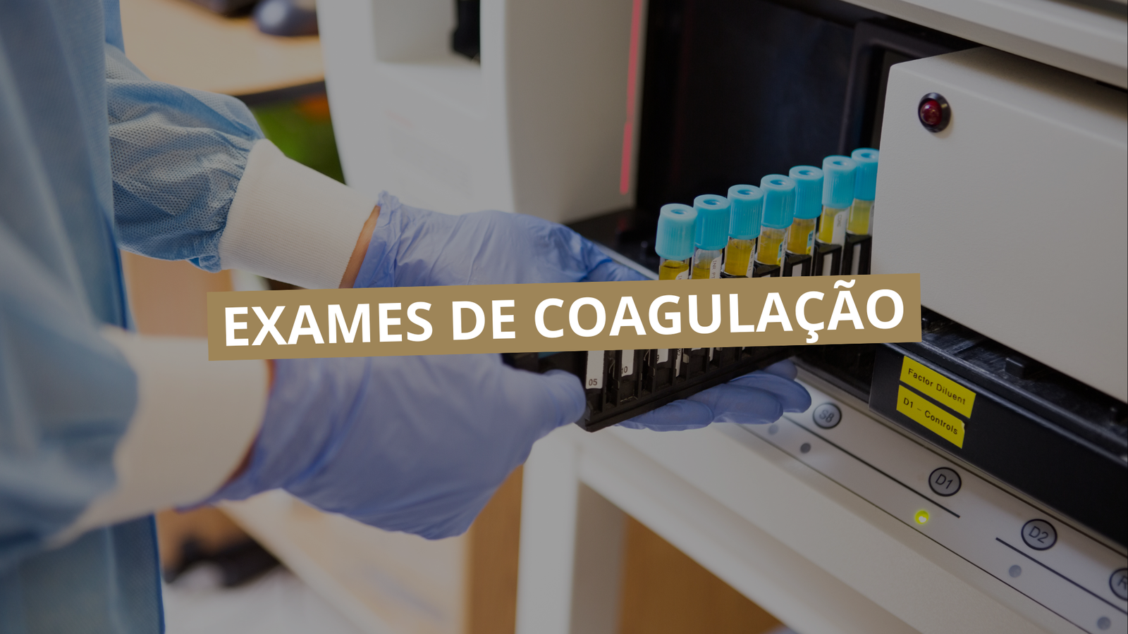 Exames de Coagulação
